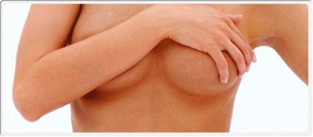 Breast Lift