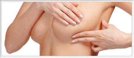 Breast Reconstruction