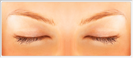 Eyelid Surgery